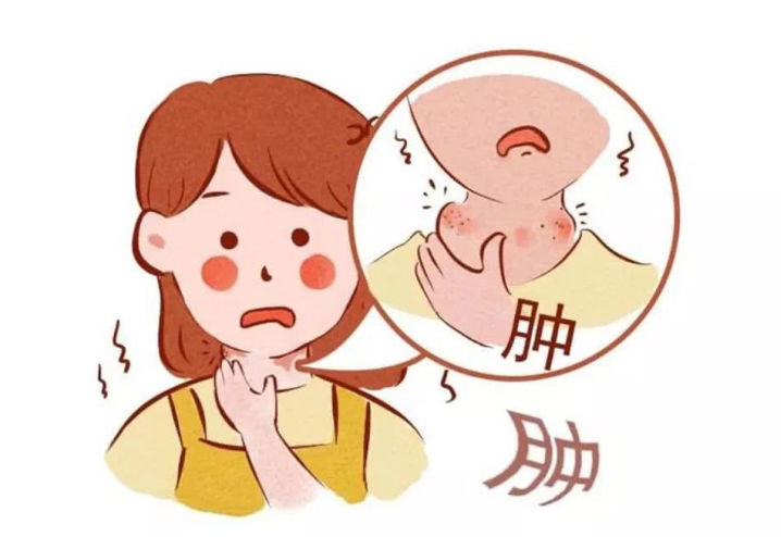 扁桃體發(fā)炎吃什么藥好得快？扁桃體發(fā)炎飲食禁忌有哪些？